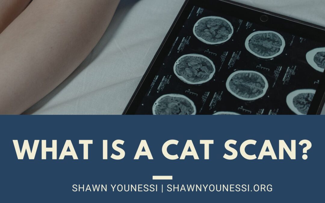 What is a CAT Scan